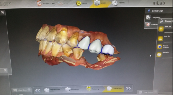 3.inlab_.PNG