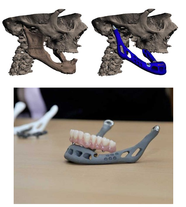 3d_프린터3.PNG