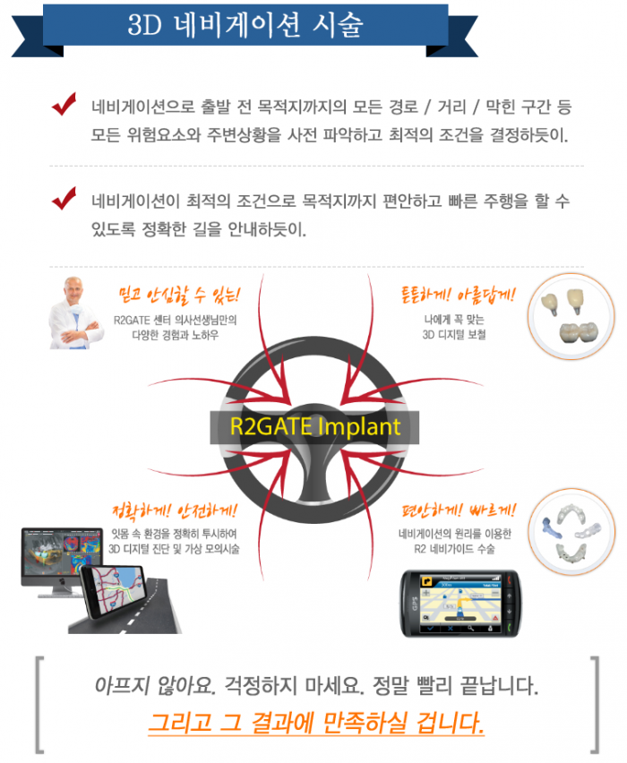 R2임플란트_설명4.PNG