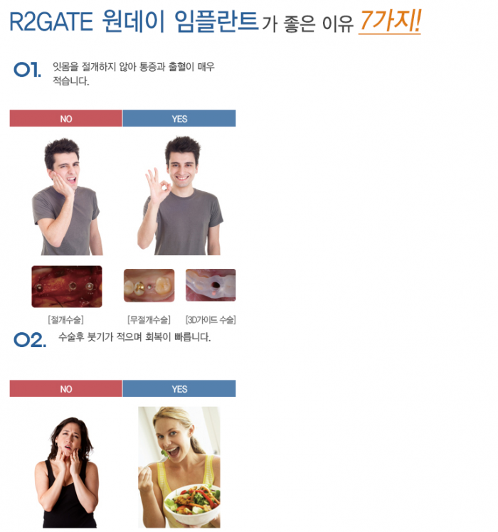 R2임플란트_설명5._.PNG