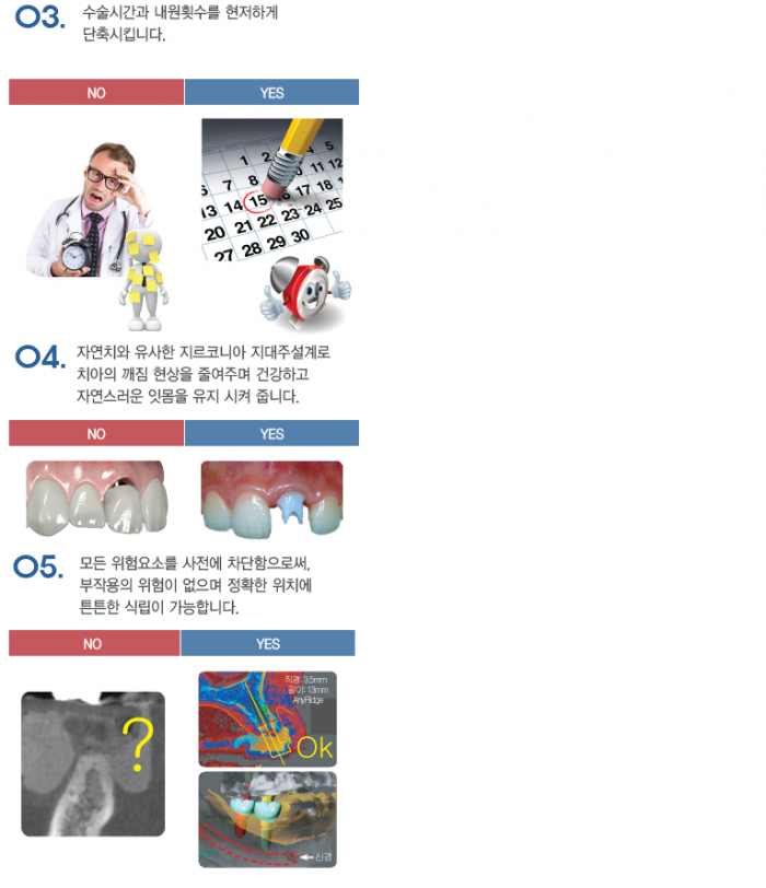 R2임플란트_설명6.PNG